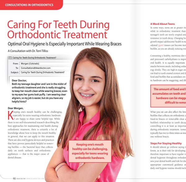 Caring for Teeth During Orthodontic Treatment