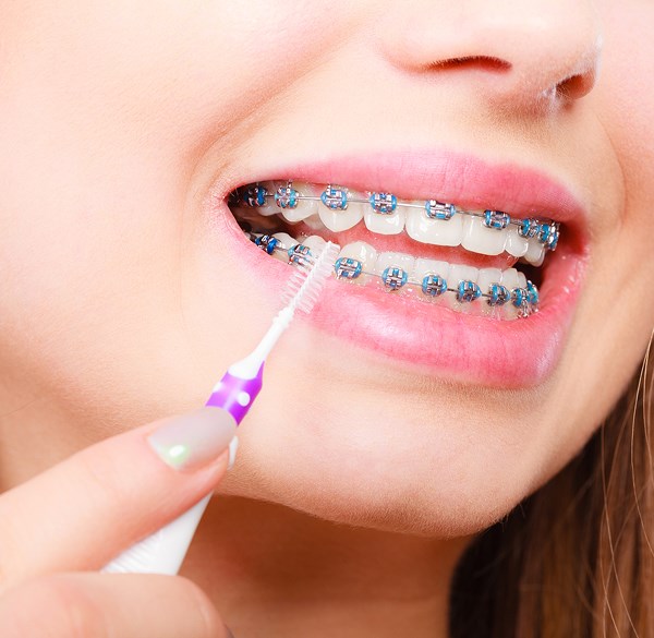 Special Brushing Tools