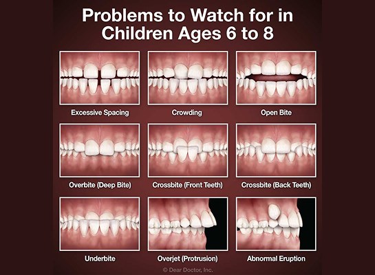 Early Treatment at Weisner Orthodontics in Massachusetts